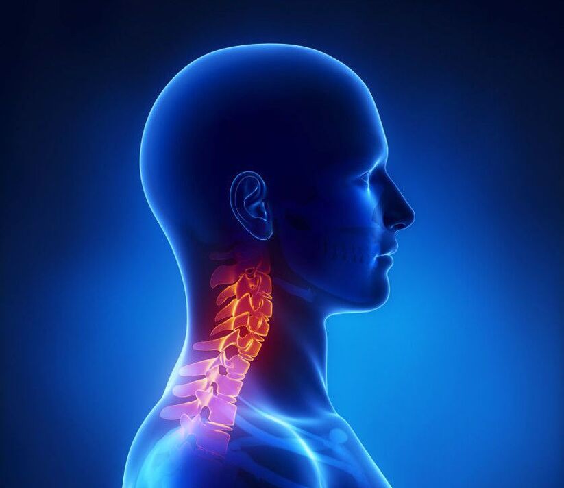 Osteochondrosis ya malzarokê patholojiya stûyê ye, ku hûn dikarin li malê jê xilas bibin