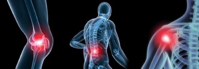 Cûreyên êş bi arthrosis