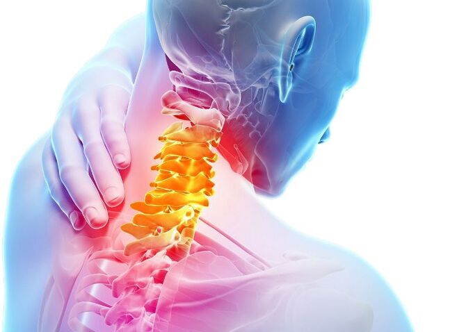 Nîşan û qonaxên pêşkeftina osteochondrosis cervical
