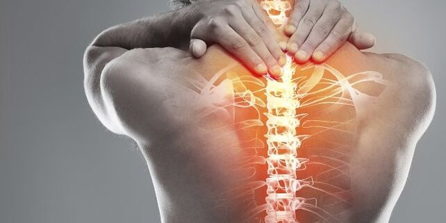 Vebijarkên bijîşkî ji bo dermankirina cervical ya osteochondrosis cervical