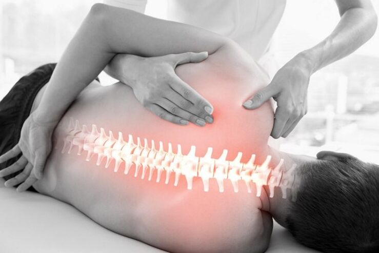 Danişîna terapiya destan ji bo osteochondrosis ya stûyê stûr