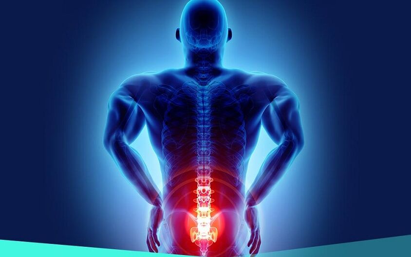 êşa ji ber arthrosisa hipê